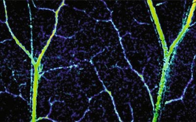 New technology gives unprecedented look inside capillaries