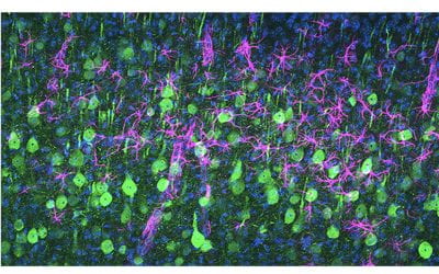 Calming the destructive cells of ALS by two independent approaches