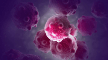 Pioneering Automated Proteoform Imaging of Ovarian Cancer Tissue